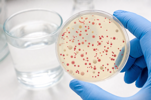 Lab petri dish of well water showing red bacterial colonies, a positive coliform and E. coli test result